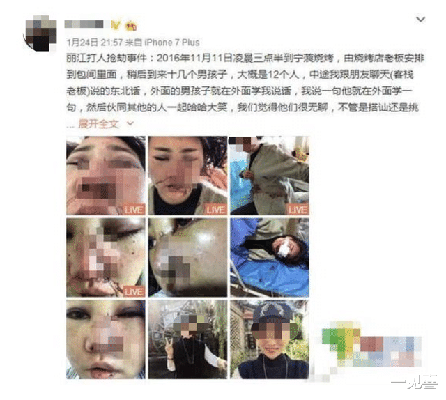 “轻伤不轻,重伤很重”,轻伤二级惹网友争议