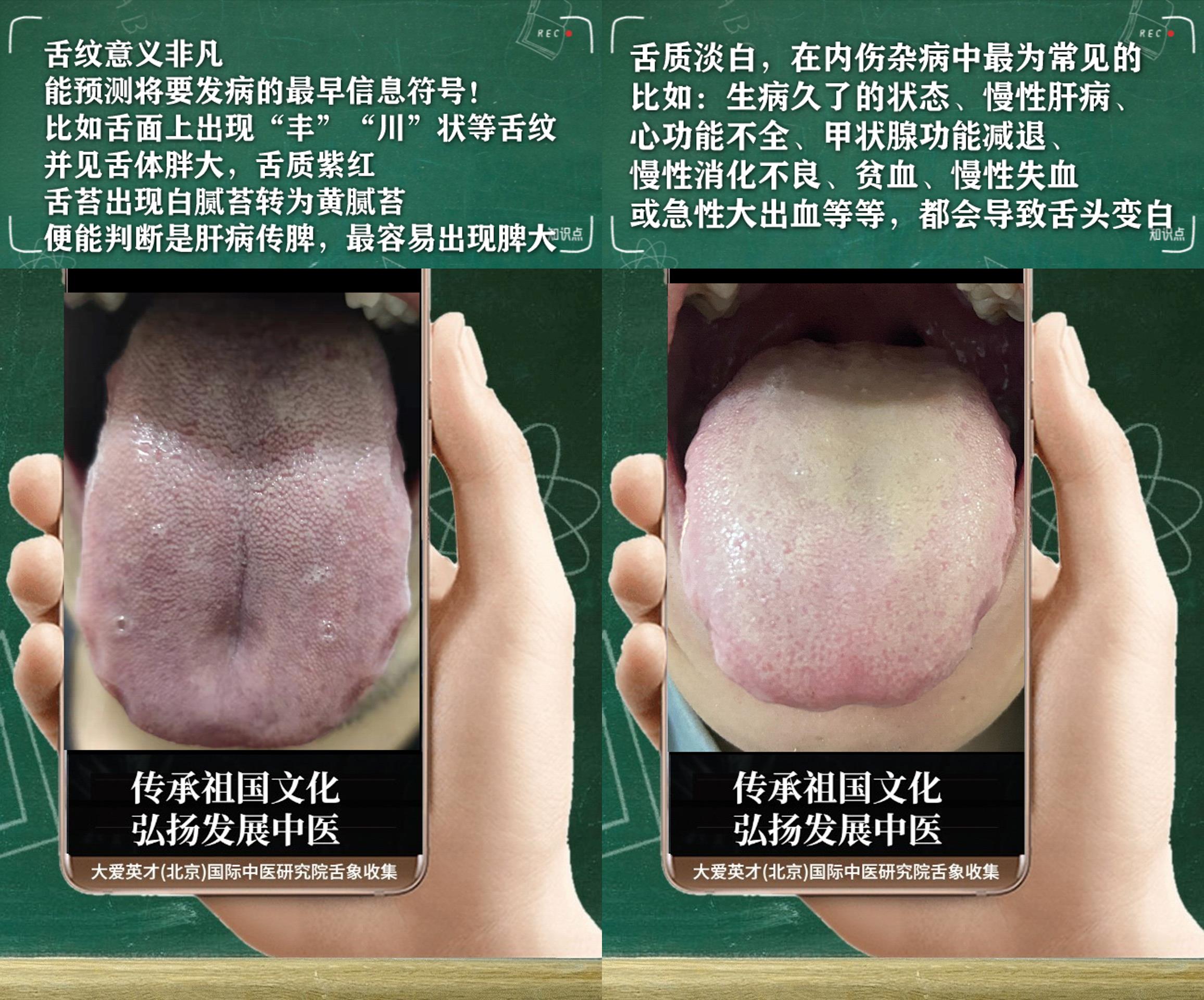 处方|中医解析：总是内心不安，心烦意乱，湿热下注，阴阳亏虚