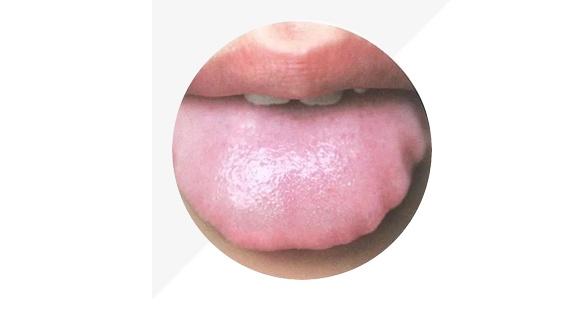 身体的秘密|中医要看舌头的原因，原来是舌头隐藏着身体的秘密，还会发生变化