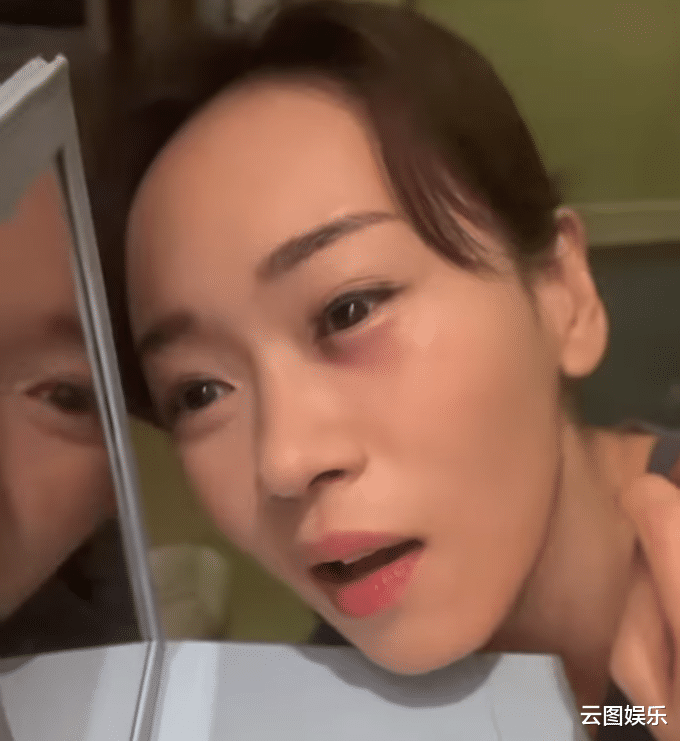 杨思琦|44岁港姐内地拍戏险变瞎子!被对手撞伤眼部,淤青红肿痛到流泪