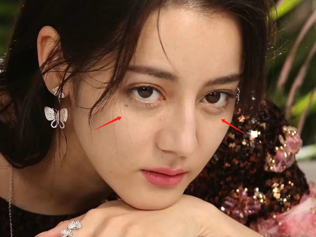 张楚楚|一组热巴未修图曝光！方形脸痘痘肌，内娱颜值天花板滤镜粉碎