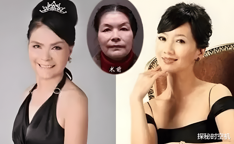 整容|2012年,六旬太婆为寻初恋情人“隆胸整容”,是真爱还是炒作?