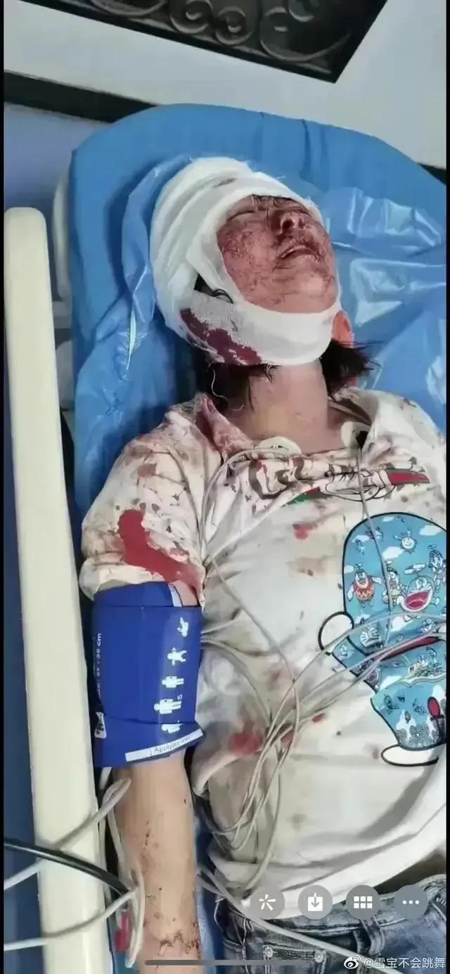 唐山被打女孩状如何?五个重点疑问,希望真相不要被压下去