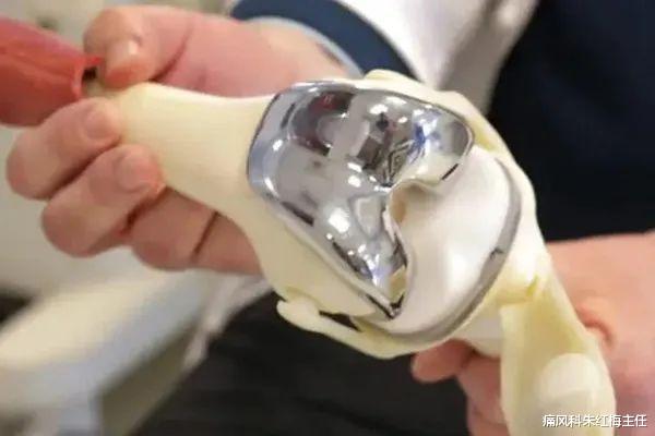 运动|骨关节炎如何避免关节置换的切肤之痛呢？