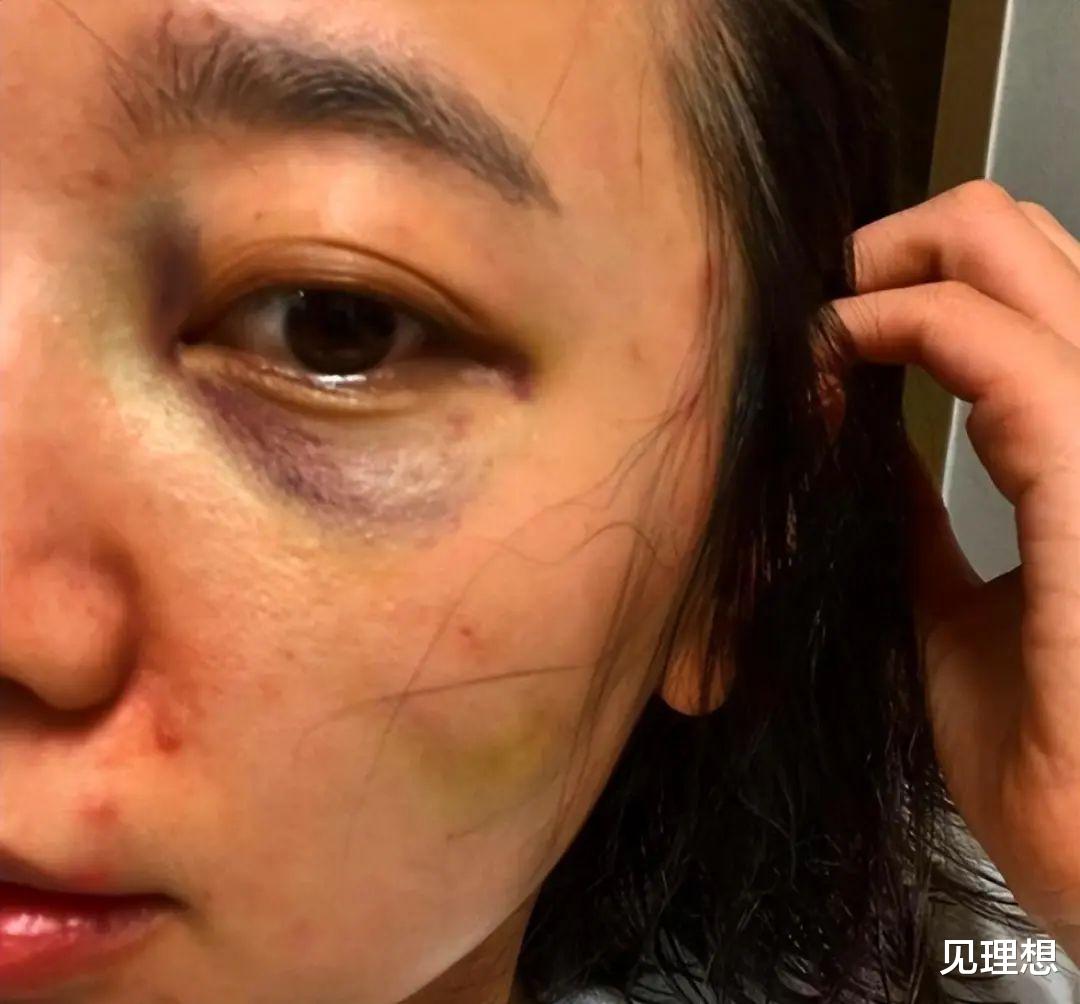 |某女星被曝婚内出轨，与老公好友多次酒店开房，还一起吸食du品！