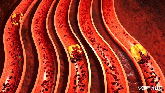 |多吃什么能软化血管？坦言：想要血管健康，不如做好这4件事
