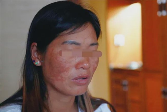 安徽女子被小三割脸百刀,毁容后还被亲生子女殴打,儿女:活该