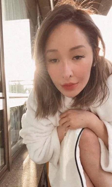 萧亚轩|萧亚轩素颜直播，受伤右脸还未完全恢复，坦言用一年多接受现实