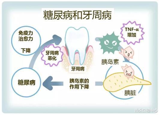 糖尿病|注意，糖尿病患者需关注口腔健康
