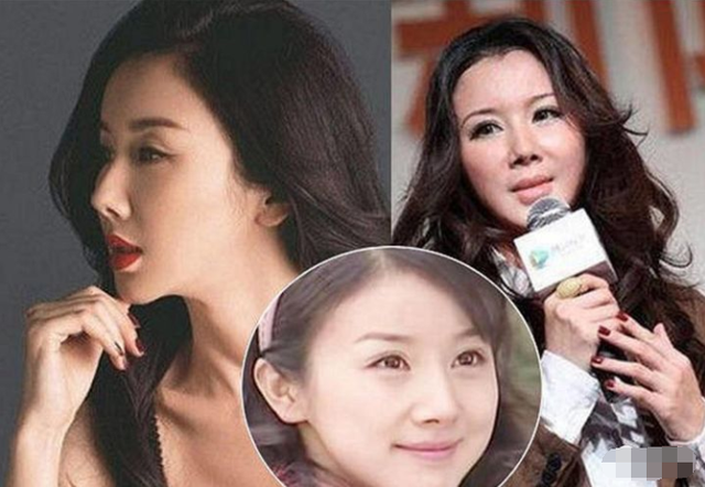 明星|这些明星们的假鼻子，绝了！都是狠人