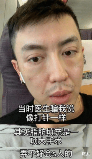 整容|网红金大威：哭诉整容失败史，小鲜肉变沧桑大叔，到底是谁害了他