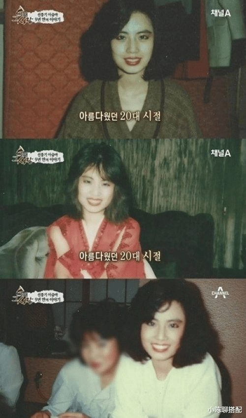 整容|“整容上瘾”的韩慧景:从眉清目秀到电扇脸,付出惨痛代价