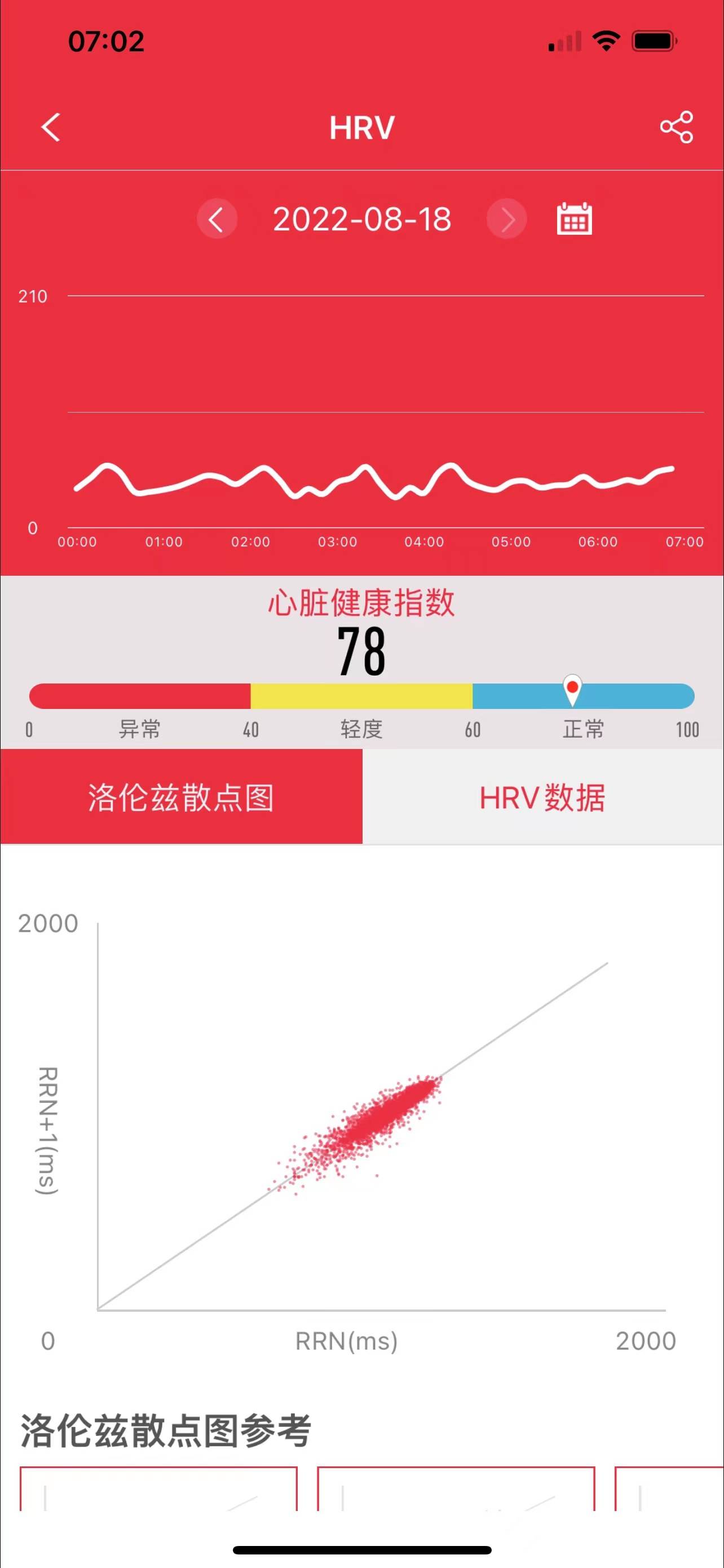 运营商|80、90后的健康新风向-dido G28S血压心电智能手表