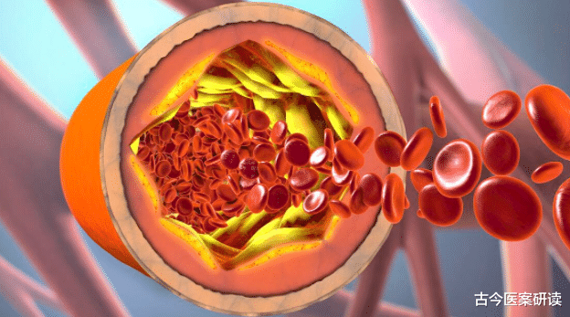 医生|“升糖王”已现身，是糖的10倍，医生：保护胰岛，“3物”应撤离餐桌