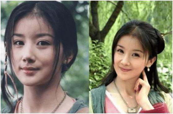 整容|7位被整容毁了的明星,有人美丽尽失事业滑坡,有人甚至赔了性命