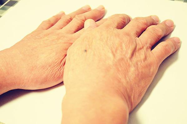 血糖|血糖太高，睡觉时可能会有四种表现，若占了两个，或需降血糖了