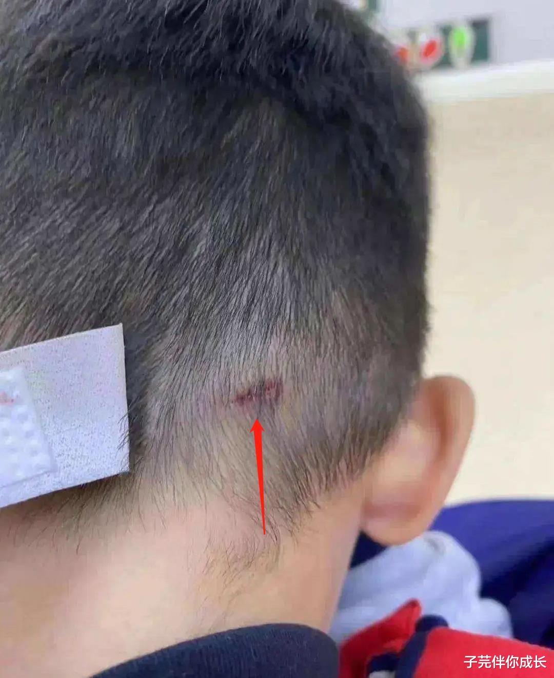 鲁医生掌掴小孩后续,邻居调解无果,对方不肯原谅:下跪也没用