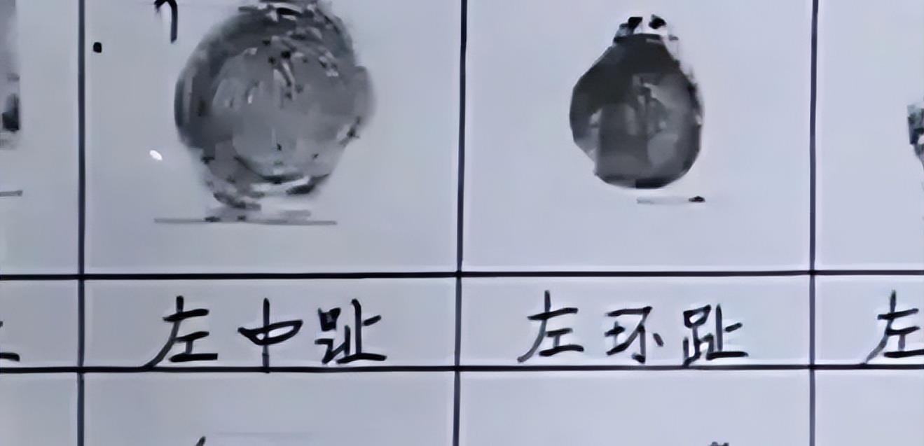 1957年浙江村庄现野人,村民抓住打死,一位老师把手脚制标本