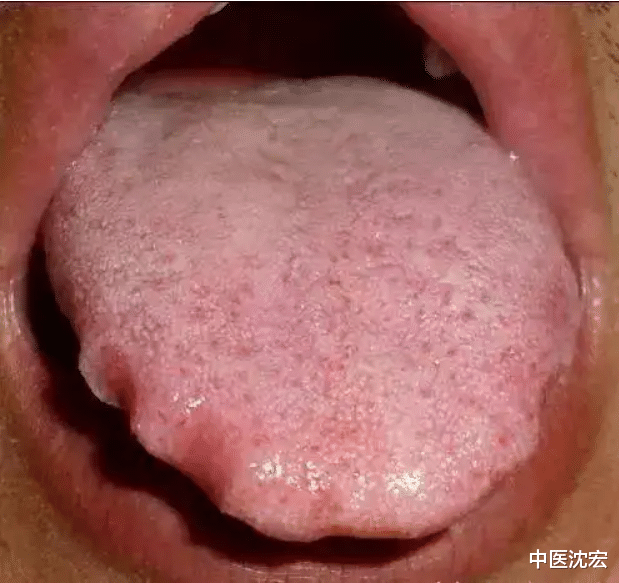 衰老|张仲景祛湿方,四味药,化痰祛湿,让你“无湿”一身轻