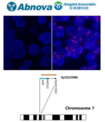 Abnova丨艾美捷EGFR FISH 探针解决方案