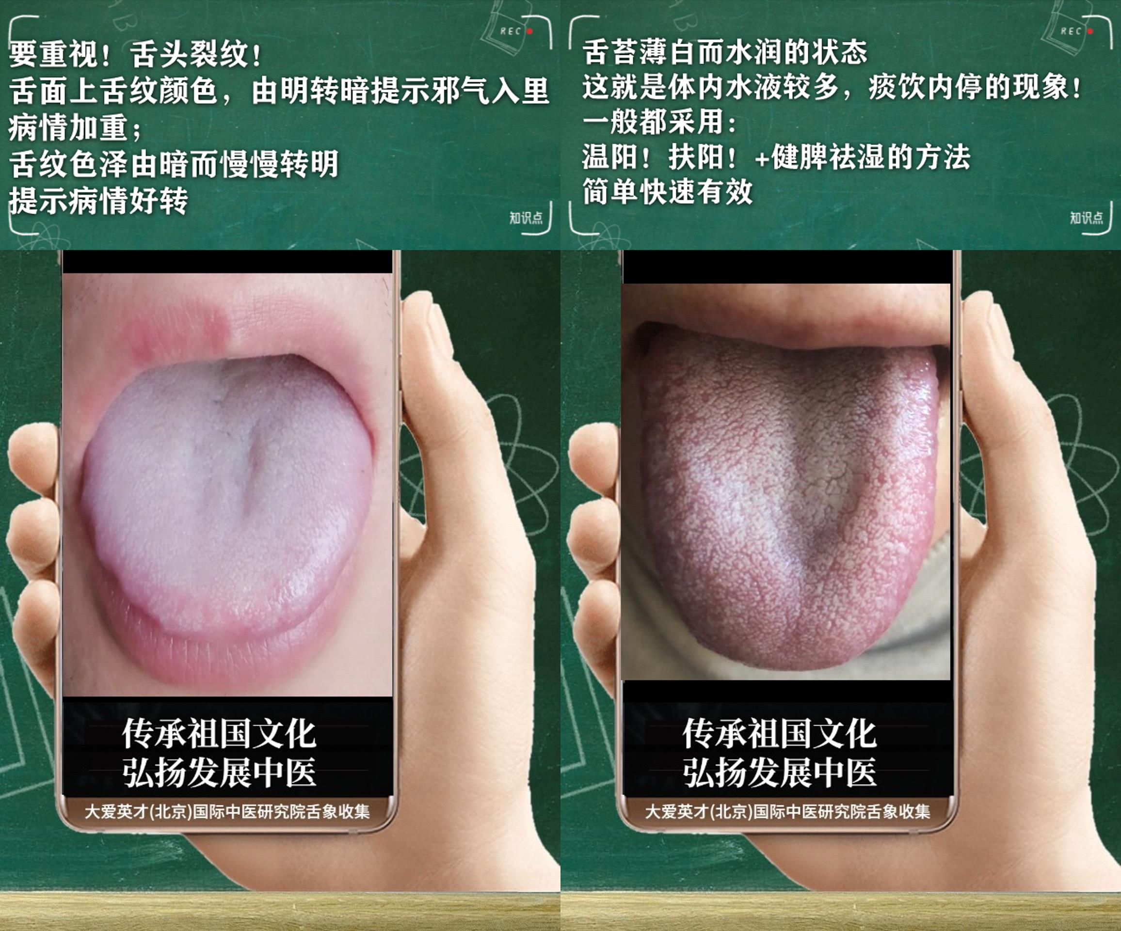 处方|中医解析：总是内心不安，心烦意乱，湿热下注，阴阳亏虚