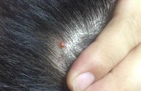 洗发水 被列入“黑名单”的4款洗发水，不知道的人还在用，难怪脱发严重