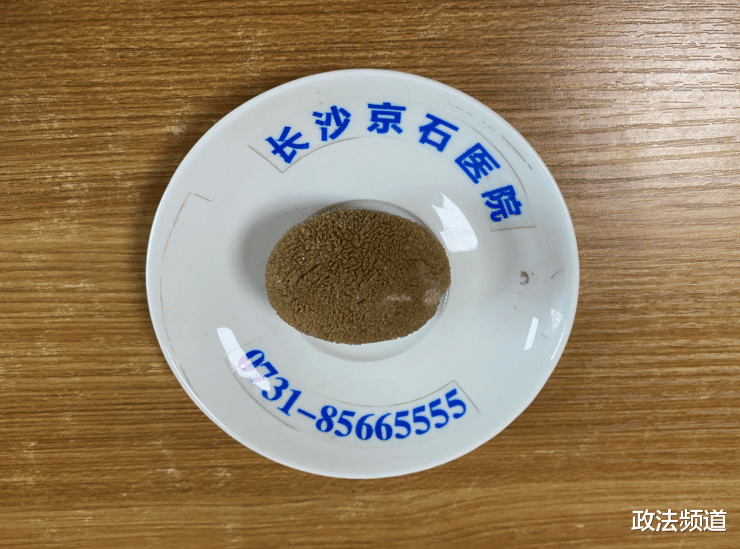 卵巢早衰|心酸!67岁男子出趟远门就要垫尿片, 一查竟是猕猴桃大结石作祟