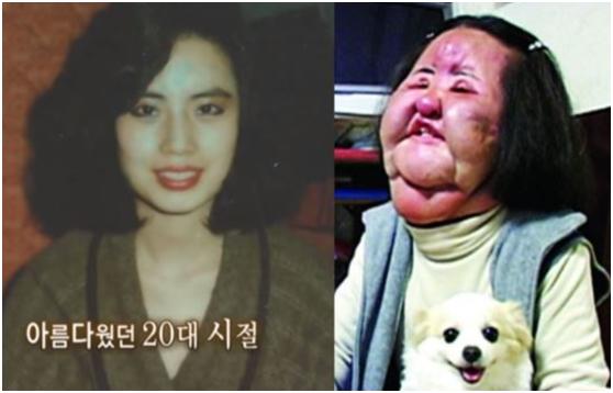 整容|7位被整容毁了的明星,有人美丽尽失事业滑坡,有人甚至赔了性命