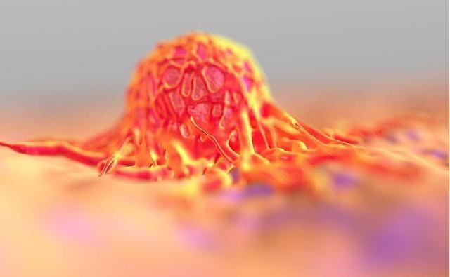 韭菜|癌症“怕”一种草，每天吃点，癌细胞可能远离你，早知早受益！