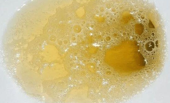 肝癌|转告高尿酸人群：这3种食物，会加速“肾衰竭”，劝你趁早扔