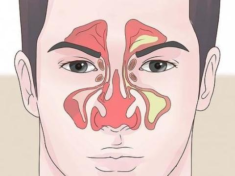 科学家发现人类的鼻腔中有着一个超级精细的微腔