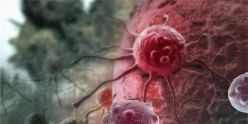 癌细胞|癌症扩散后,治疗还有用吗?出现3种症状,可能是癌细胞已经转移