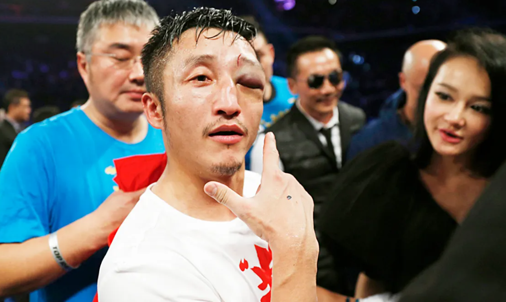 |综艺里那些意外事故，个个让人深思！