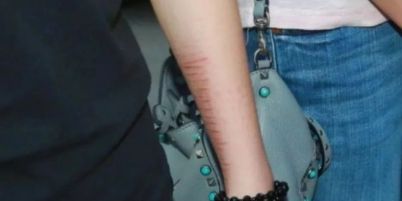 吴卓林|吴卓林被曝领免费食物，走到这一步不单是她的错，还有2个人有责任