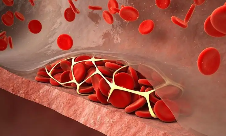 胆固醇|升脂“大户”被公布,鸡蛋排末尾,榜首胆固醇“成倍增”,很多人当补品