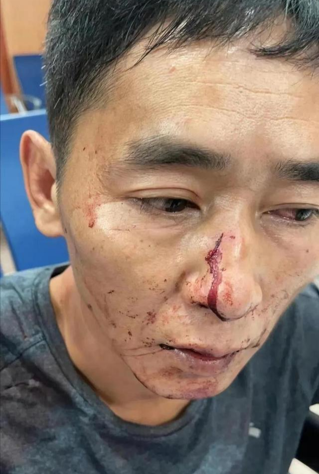 成毅《莲花楼》剧组场务打人后续,代拍鼻骨骨折,已经被警察带走