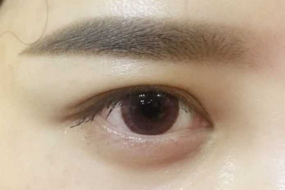 卸妆|眼部卸妆不能马虎