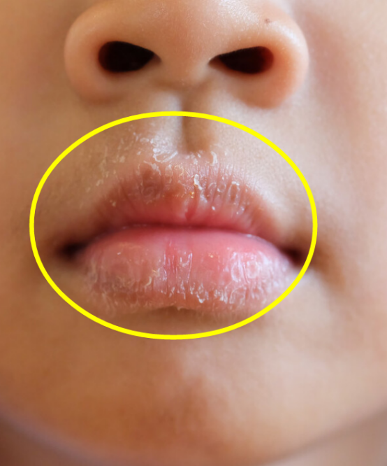医学|想知道孩子的脾虚不虚,看看嘴唇就知道啦!