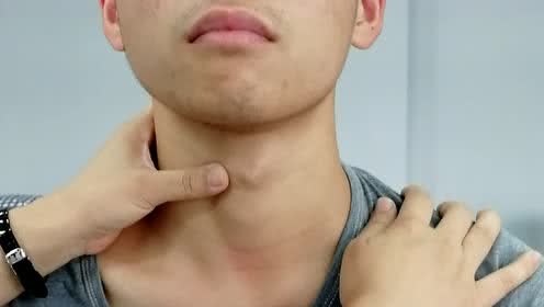 高血压|多所高校共同呼吁：停食“1玉米”，或是在甲状腺上“撒盐”，少碰为妙