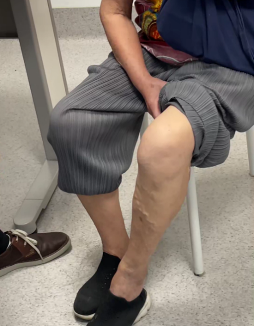 |右腿好了左腿坏，蚯蚓缠身真奇怪！老人说：还得找对人来看！