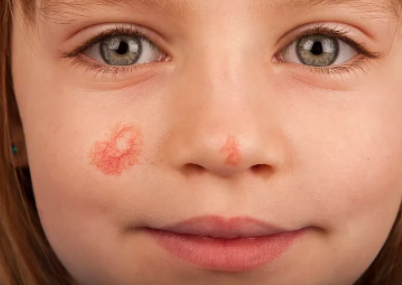 肝癌|30岁女教师坚持早睡3年，肝癌离世，医生：睡前“1习惯”或等于自残