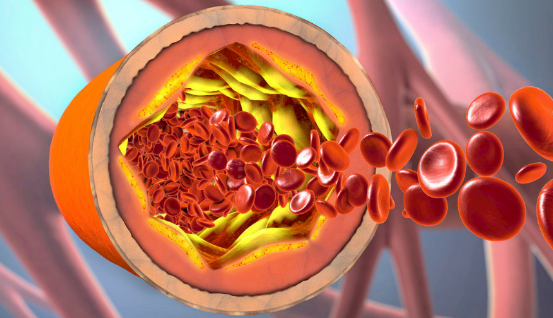 洋葱|吃一口堪比5斤洋葱,提醒:血脂高的人敞开吃,脑梗不敢“上门纠缠”