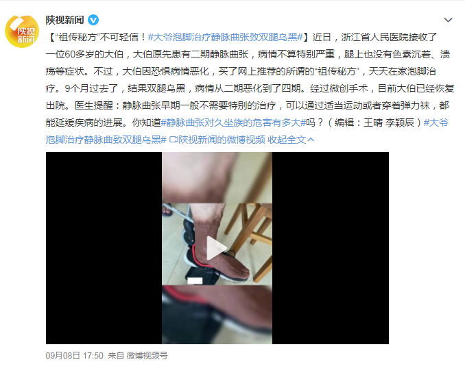 静脉曲张|六旬老人本想舒舒服服泡个脚,没想到竟加重了老毛病,双腿发黑!