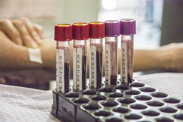 葡萄糖注射液|医生动不动就抽血,抽血到底能干啥?抽出来的血去哪了?