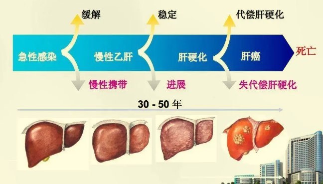 肝炎|肝炎的“帮凶”找到了，很多人都不知道，难怪肝病总好不了！