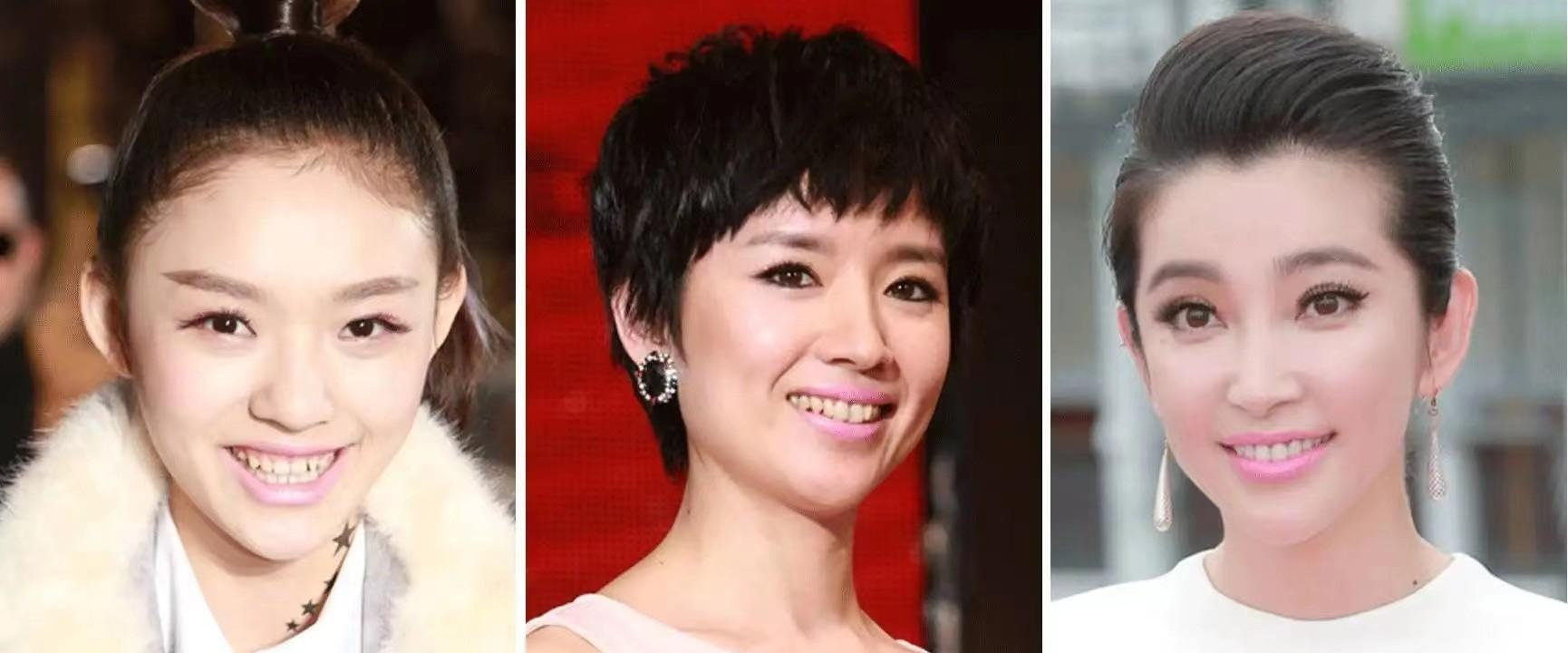 明星|假牙假胸假屁股，内娱“从头假到脚”，原来没有什么是真的