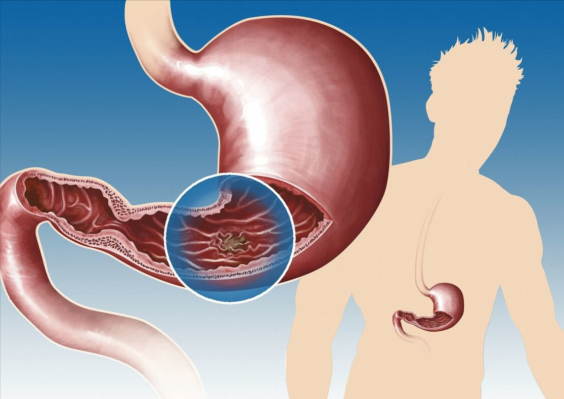 酸奶|胃痛胃胀别傻傻吃药!常吃这种“养胃”食物,养胃更护胃!