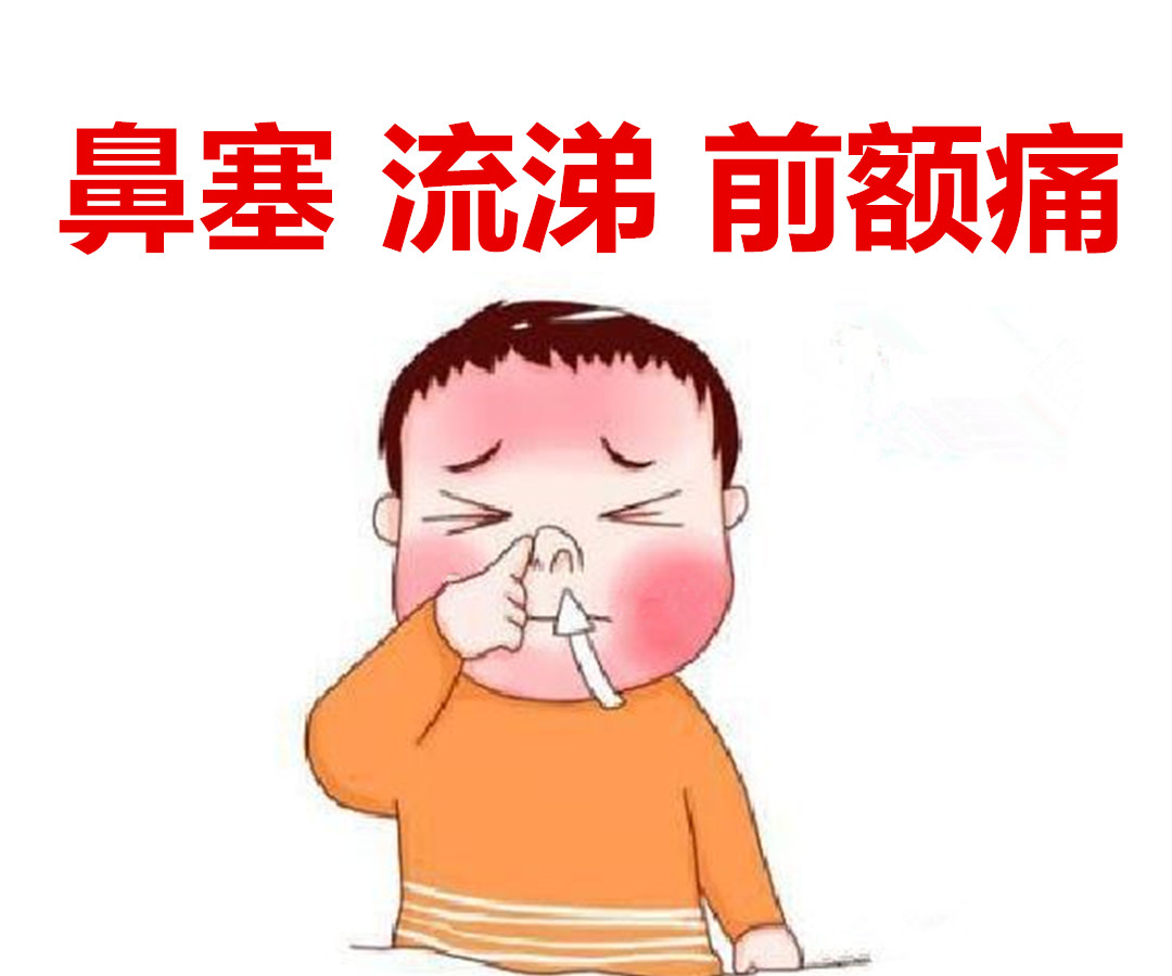 医生|给大家分享一个中医治鼻炎的常用中成药,大家记得点赞、收藏