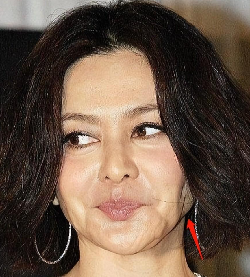 整容|在当奶奶的年纪整容，如今脸垮得没眼看，这些女星肠都悔青了吧