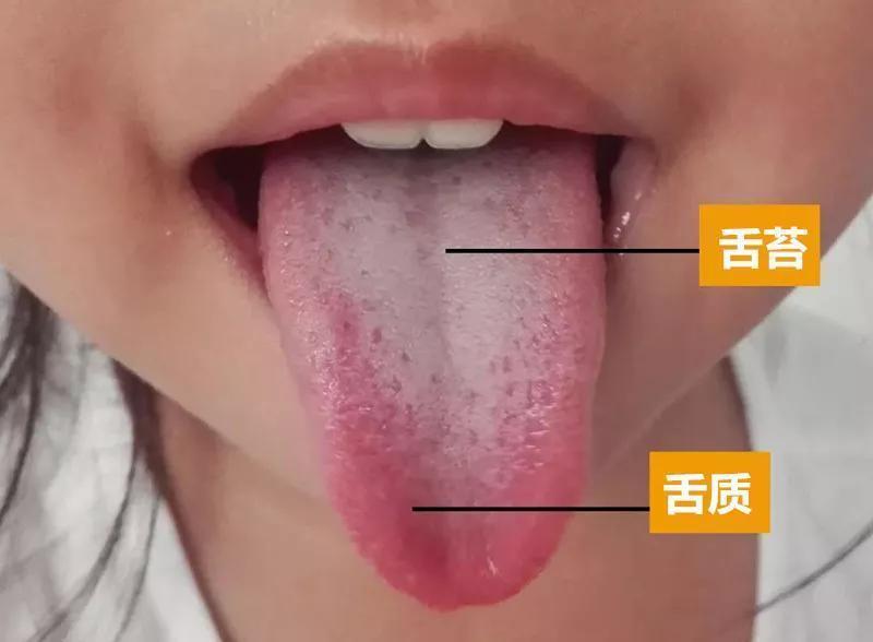 针灸|多名院士呼吁停止食用:比添加剂还伤脾胃,提醒家长:趁早撤下餐桌